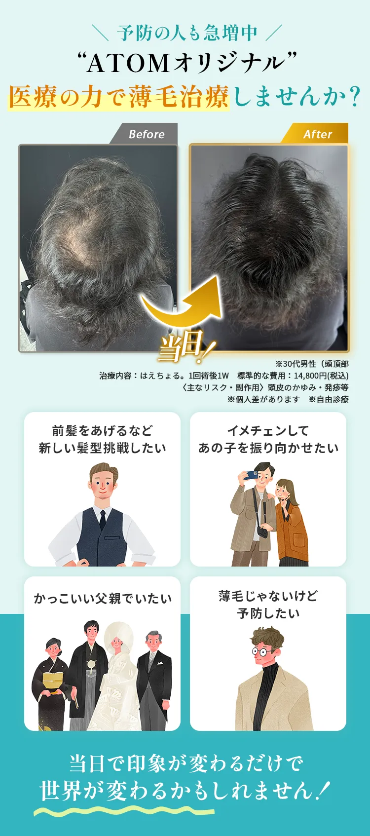 \予防の人も急増中/ “ATOMオリジナル”医療の力で薄毛治療しませんか？