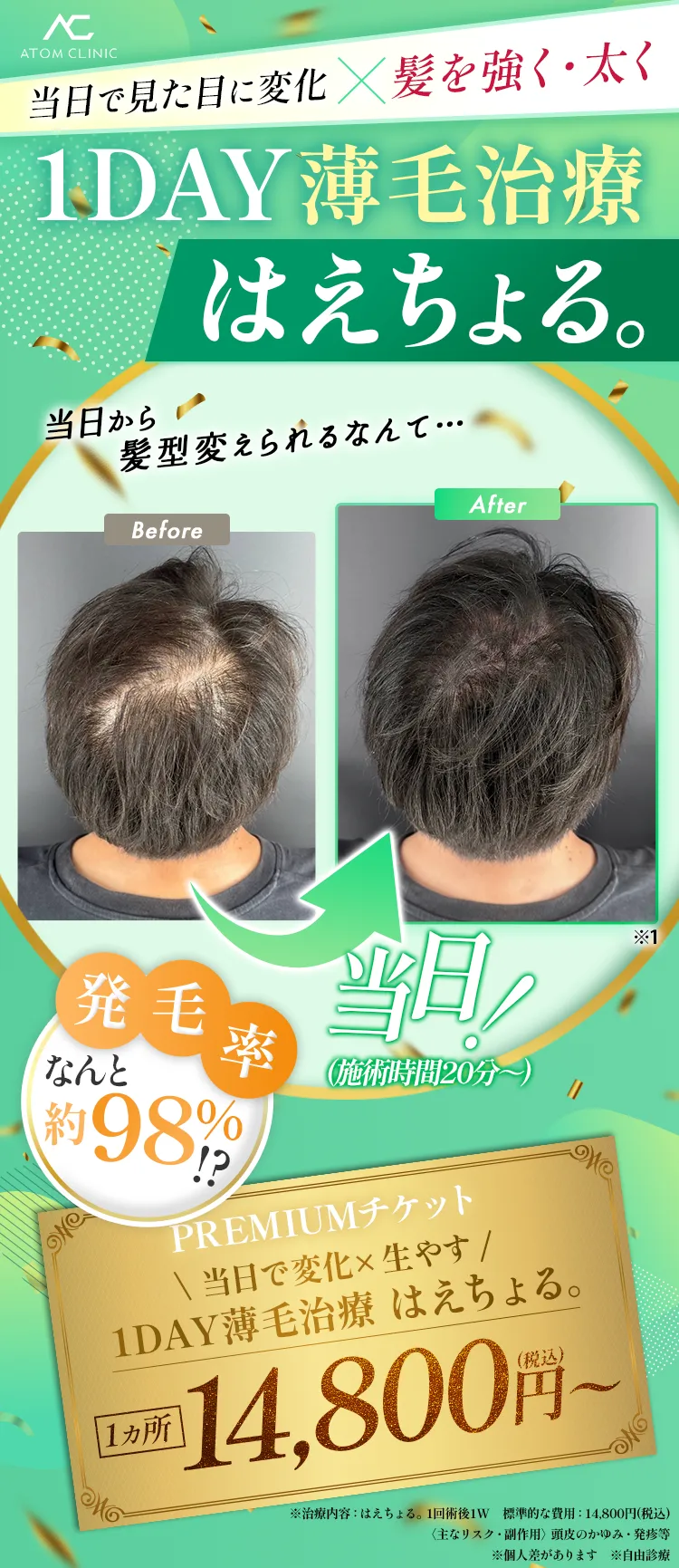 \見た目に変化×髪を強く・太く はえちょる。