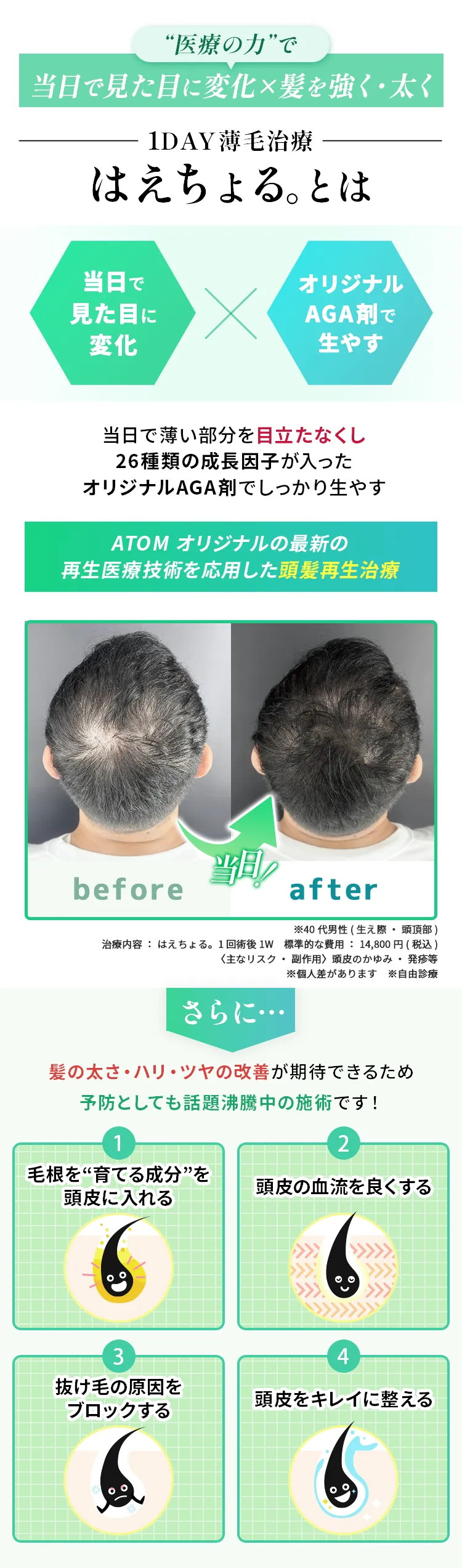 “医療の力”で即日で見た目に変化×髪を強く・太く 1DAY薄毛治療 はえちょる。とは