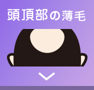 頭頂部の薄毛