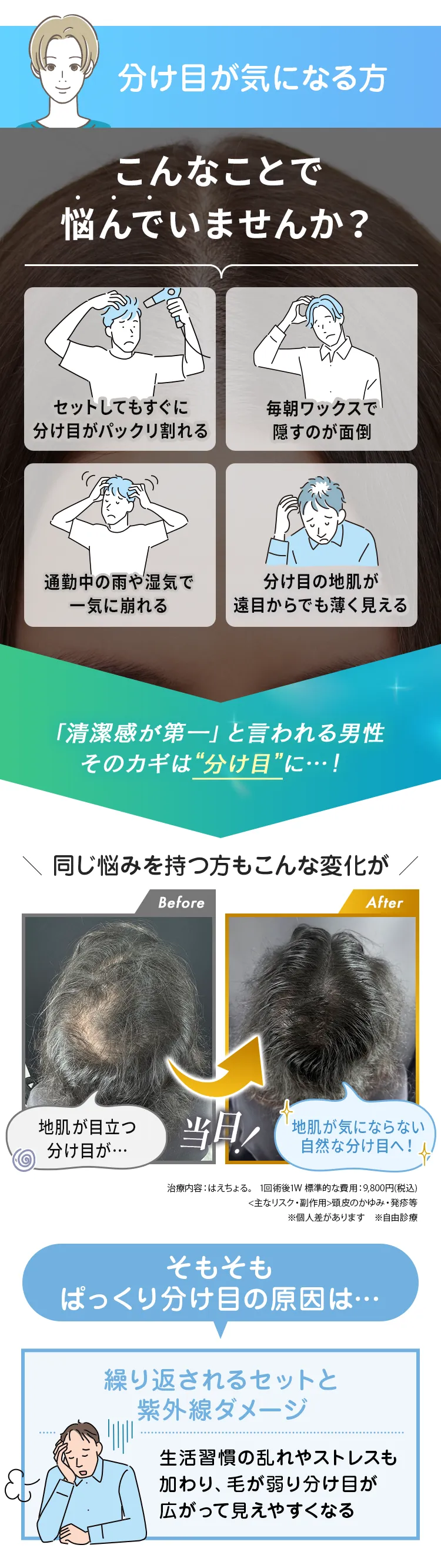 分け目の広がり