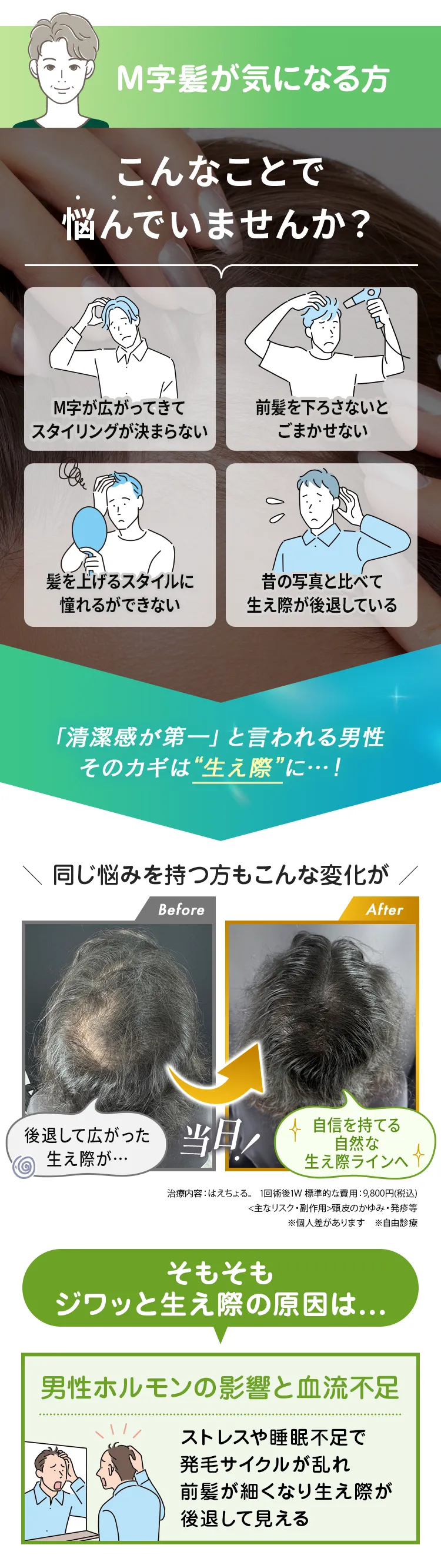 生え際の後退