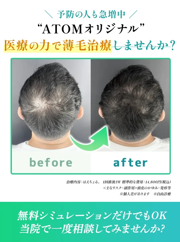 予防の人も急増中